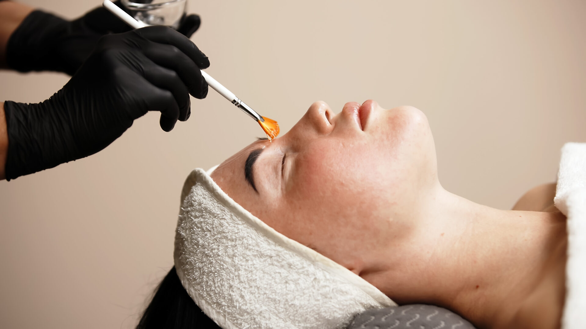 Professional Chemical Peels
