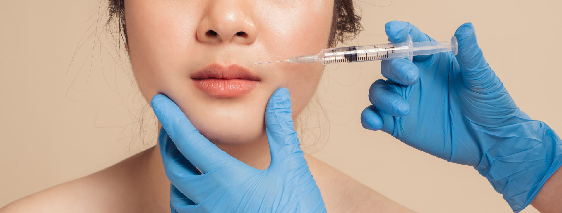DERMAL FILLERS