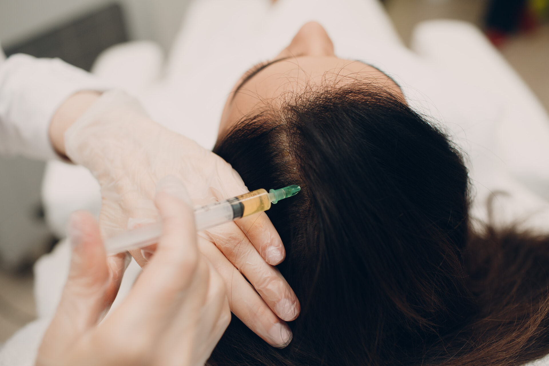 PRP / PRFM Hair Restoration
